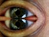 Talk About Double Vision by George Zimmerman