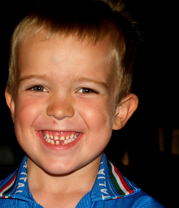 Proud for loss of tooth