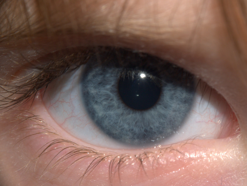 Blue Eye