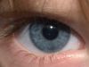 Blue Eye